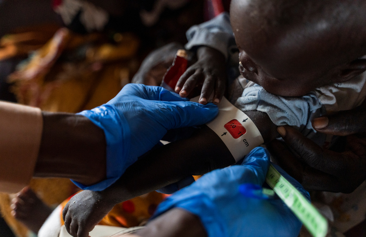 Un enfant fait l'objet d'un examen de malnutrition