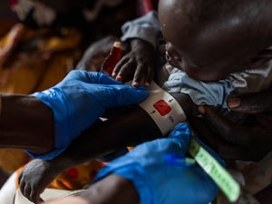 A child is assessed for malnutrition at a health facility in Um Sagour camp in Sudan.