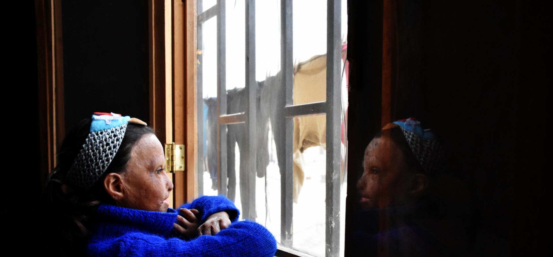 Syria. Living with the scars of war.