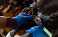 UNHCR e OMS avvertono: si aggrava la situazione sanitaria in Sudan, 1.200 bambini morti per sospetto morbillo e malnutrizione