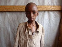 中央アフリカの犠牲者：家族と再会する前に亡くなった少年