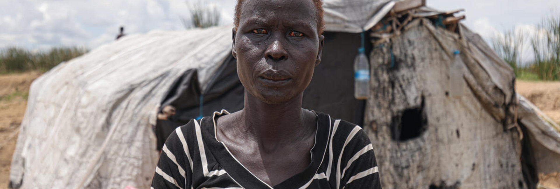 South Sudan. Severe floods worsens plight for thousands displaced by conflict