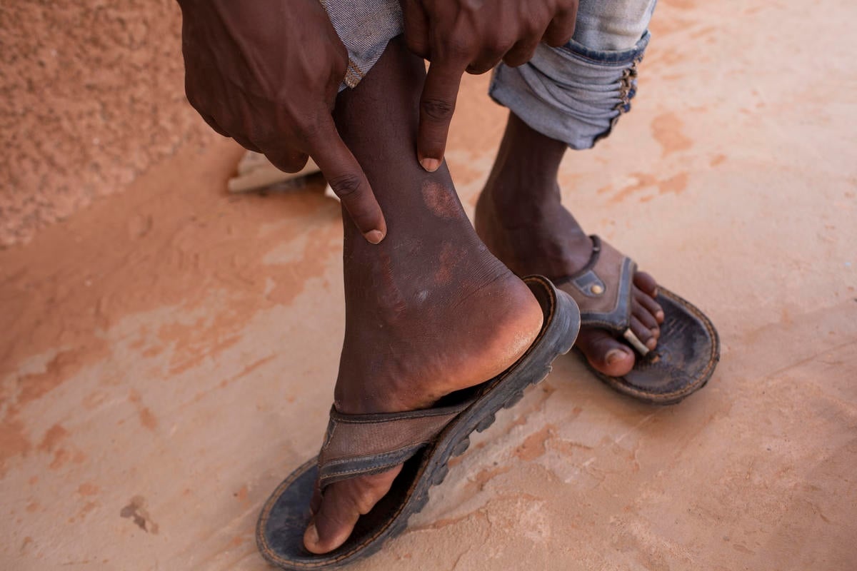 Niger. Hellish ordeal finally over for Sudanese torture victim trapped in Libya