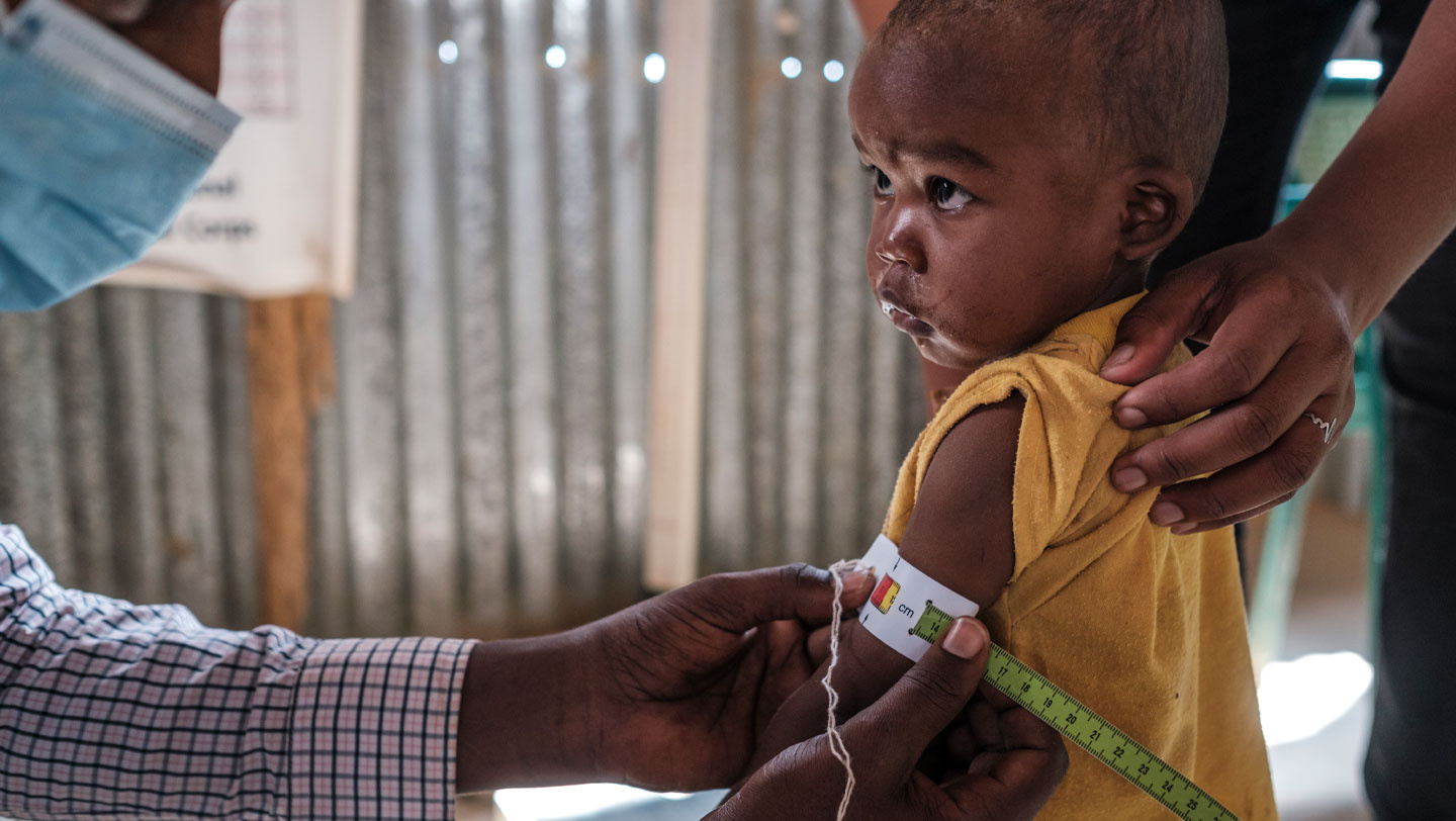 ประเทศเอธิโอเปีย เด็กๆ และครอบครัวผู้ลี้ภัยที่เดินทางมาถึงใหม่เข้ารับการลงทะเบียนและตรวจร่างกาย © UNHCR/Eduardo Soteras Jalil