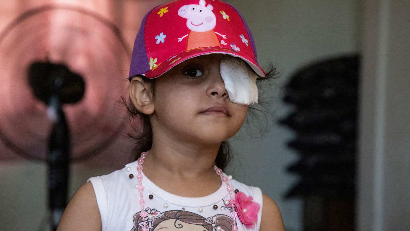 Sama wears a patch over her left eye after it was injured in the explosion. © UNHCR/Sam Tarling