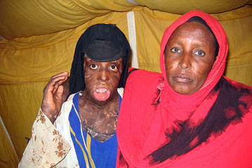 Somali girls in canada