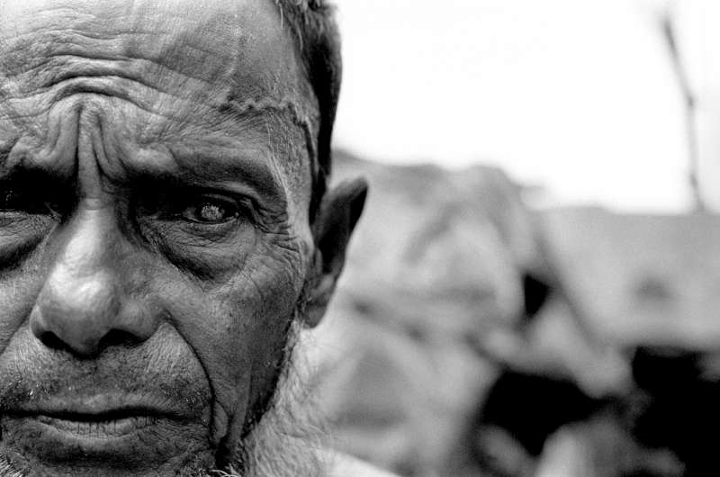Blind in one eye after being struck by a foreman while engaged in forced labour, this Rohingya man fled from Myanmar in the mid-1990s. He is one of an estimated 200,000 refugees living in southern Bangladesh. Most stateless people are not refugees, but those who are must be treated in accordance with international law. 