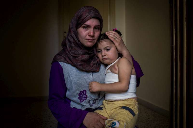Yemen, 5, and her mother, Dayane, 24, are pictured at their home in northern Lebanon. On a cold night in November 2013, Yemen ran into the kitchen, petrified by the sound of the bombs that were falling around their house in Yabroud, Syria. In the commotion, she ran into the stove and knocked over a pot with boiling water that fell on her. 