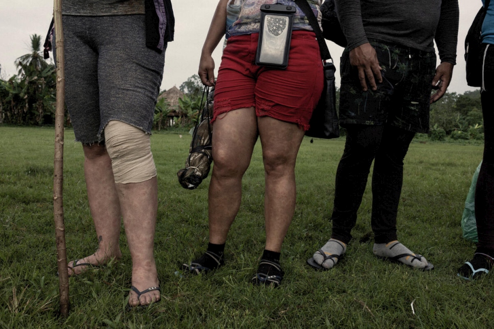 نساء يظهرن أرجلهن وقد لسعها البعوض بعد السير في أدغال داريين.