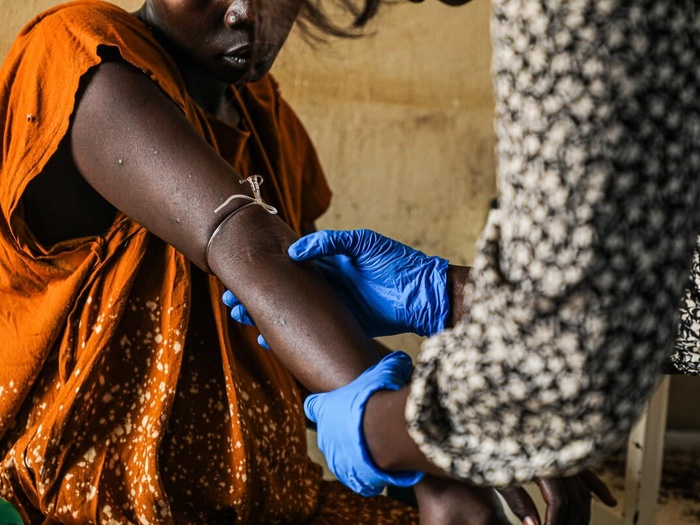 South Sudan. Patient receiving malaria medication at the Gorom Primary Health Care Center (PHCC)