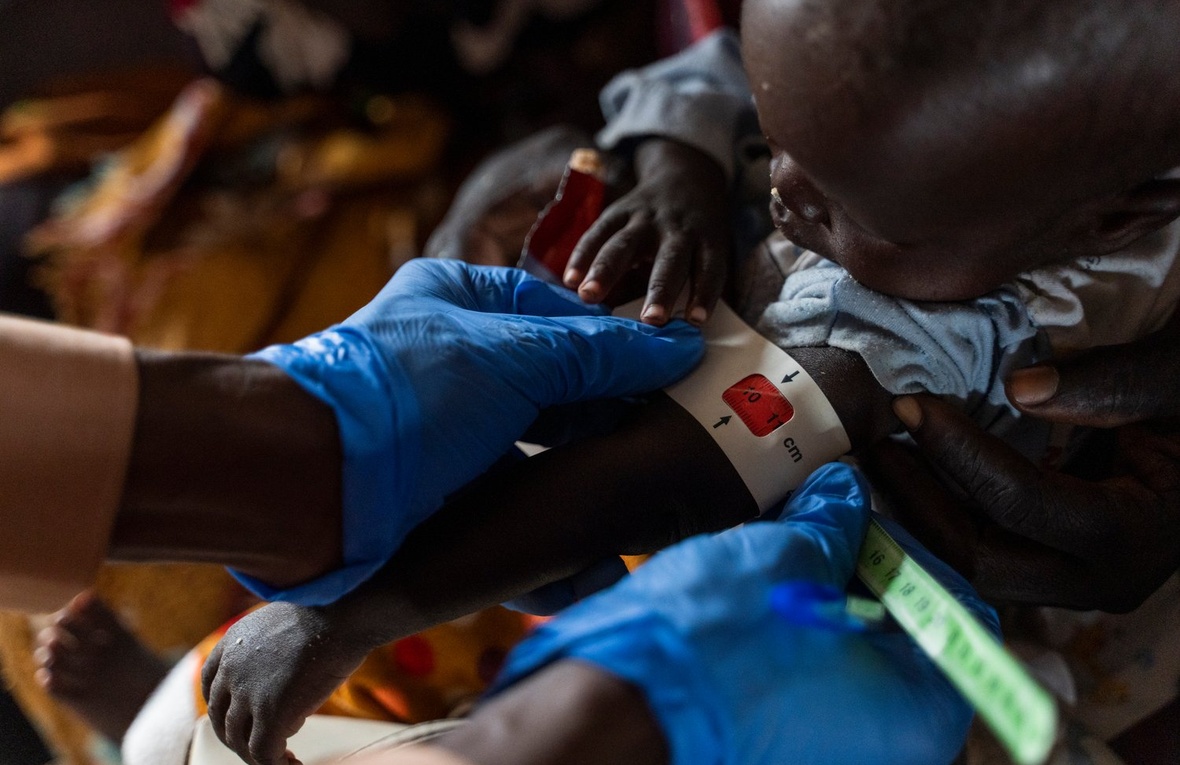 A child is assessed for malnutrition at a health facility in Um Sagour camp in Sudan.