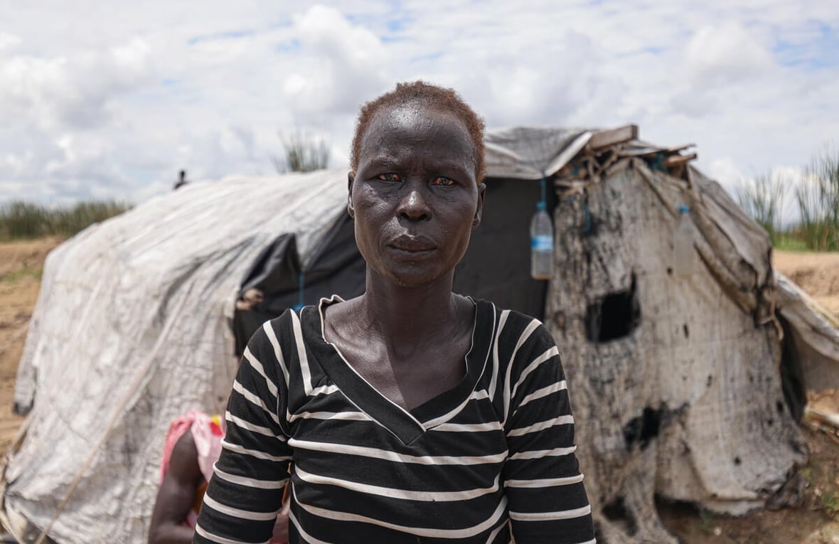 South Sudan. Severe floods worsens plight for thousands displaced by conflict