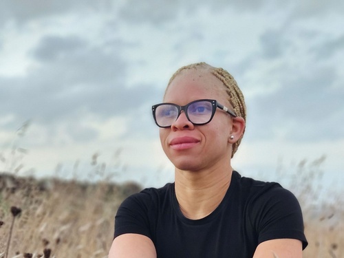 An Albino woman wearing glasses sits in a field looking into the distance, with her hair tied back