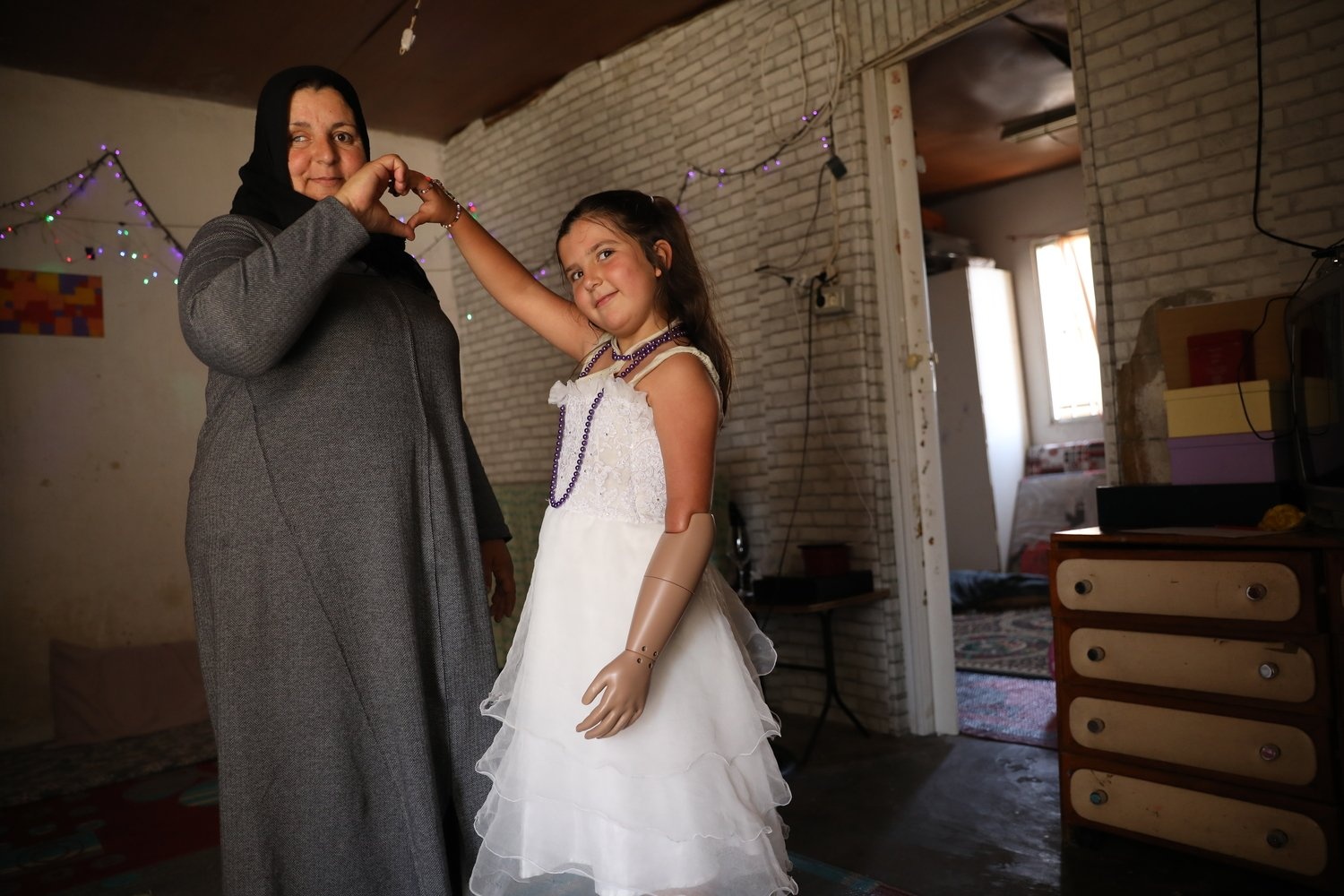 A girl with a prosthetic arm poses in a white dress, holding her mother's hand.