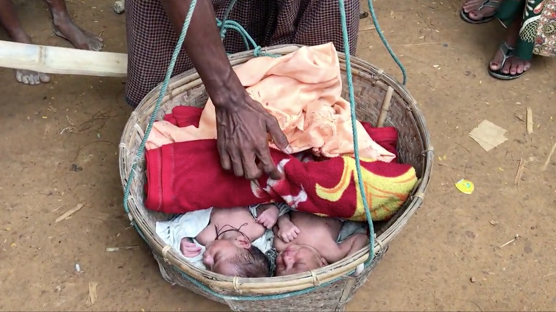 These Rohingya twins barely survived